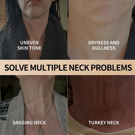 Neck-Eye Care Tightening & Revitalizing Set - Smooth of Fine Lines, Eye & Neck Treatment, Skin Moisturizer, Deep Moisturizing Skincare