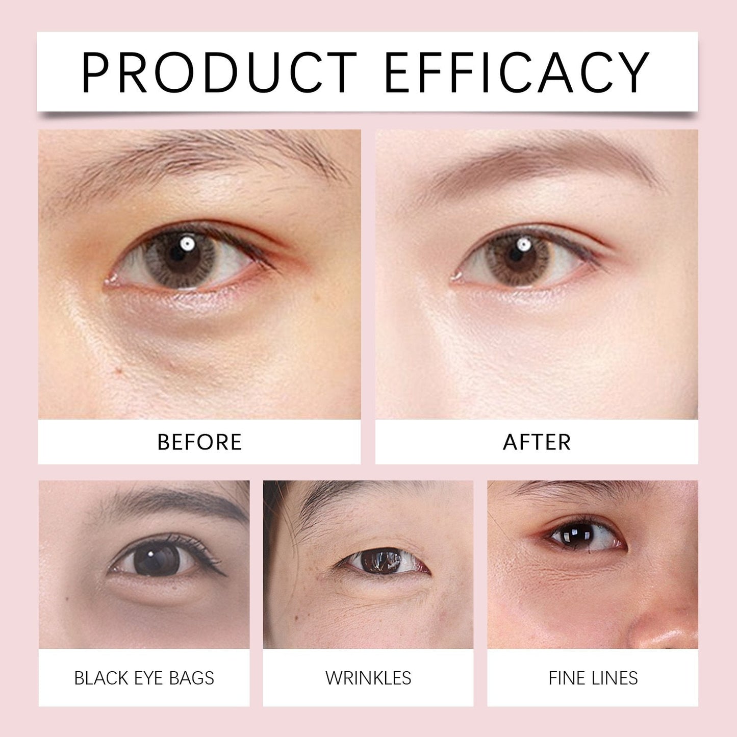 Neck-Eye Care Tightening & Revitalizing Set - Smooth of Fine Lines, Eye & Neck Treatment, Skin Moisturizer, Deep Moisturizing Skincare