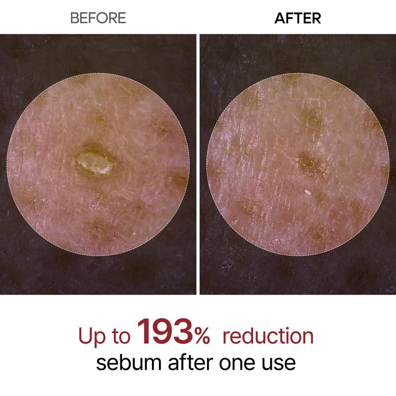🔥LAST DAY SALE 70% OFF 🔥 Peel Shot Glow Rice Ampoule Duo - Serums for Brightening, Exfoliating, and Moisturizing🌾