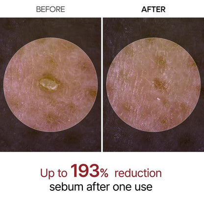 🔥LAST DAY SALE 70% OFF 🔥 Peel Shot Glow Rice Ampoule Duo - Serums for Brightening, Exfoliating, and Moisturizing🌾
